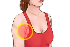 Koltuk Altı Memesi Belirtileri ve Tedavisi